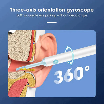Matchless® - Ear Wax Removal Pro
